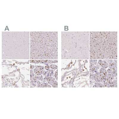 Immunohistochemistry-Paraffin: MMR/CD206/Mannose Receptor Antibody [NBP1-90020]