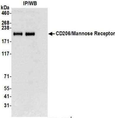 Immunoprecipitation: MMR/CD206/Mannose Receptor Antibody (BLR109H) [NBP3-14698]