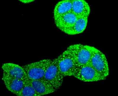 Immunocytochemistry/ Immunofluorescence: MMR/CD206/Mannose Receptor Antibody (JF0953) [NBP2-66956]