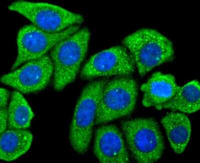Immunocytochemistry/ Immunofluorescence: MMR/CD206/Mannose Receptor Antibody (JF0953) [NBP2-66956]