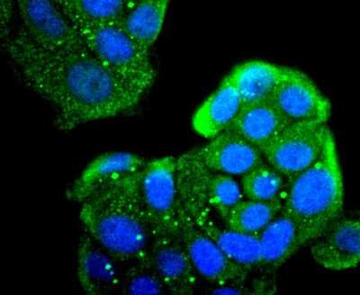 Immunocytochemistry/ Immunofluorescence: MMR/CD206/Mannose Receptor Antibody (JF0953) [NBP2-66956]