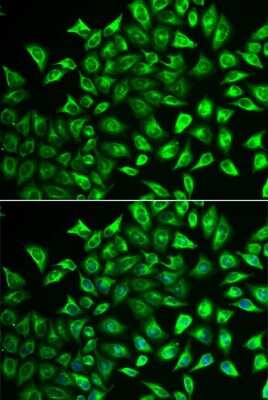 Immunocytochemistry/ Immunofluorescence: MMRN1 Antibody - Azide and BSA Free [NBP3-05185]