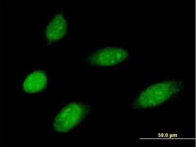 Immunocytochemistry/ Immunofluorescence: MMS19 like protein Antibody [H00064210-B01P]
