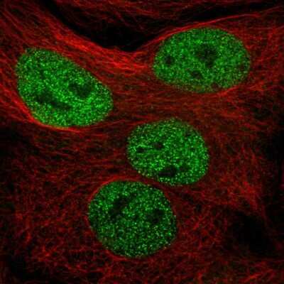 Immunocytochemistry/ Immunofluorescence: MMS19 like protein Antibody [NBP2-47371]