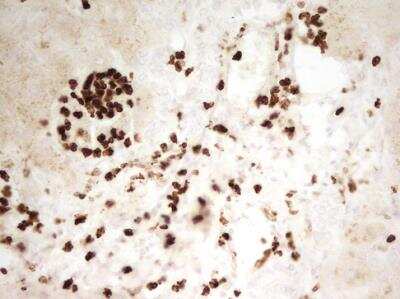 Immunohistochemistry-Paraffin: MNDA Antibody (OTI4H6) - Azide and BSA Free [NBP2-72741]