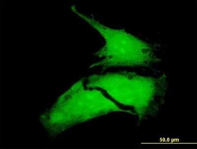 Immunocytochemistry/ Immunofluorescence: MNK1 Antibody (2C5) [H00008569-M07]