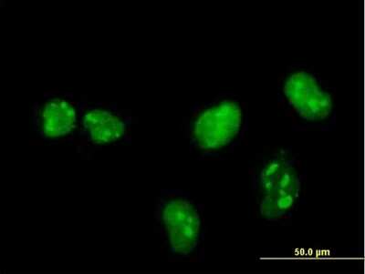 Immunocytochemistry/ Immunofluorescence: MNK1 Antibody (2F12) [H00008569-M14]