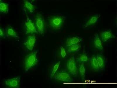 Immunocytochemistry/ Immunofluorescence: MNK1 Antibody (2H8) [H00008569-M08]
