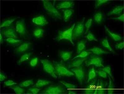 Immunocytochemistry/ Immunofluorescence: MNK1 Antibody (3E1) [H00008569-M06]