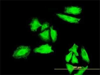 Immunocytochemistry/ Immunofluorescence: MNK1 Antibody (5E2) [H00008569-M05]