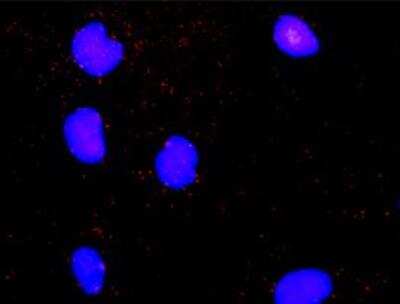 Proximity Ligation Assay: MNK2 Antibody (2A10) [H00002872-M07]