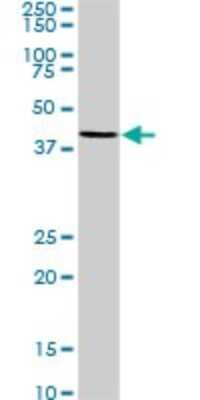Western Blot: MNK2 Antibody (2A10) [H00002872-M07]