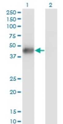 Western Blot: MNK2 Antibody (2A10) [H00002872-M07]
