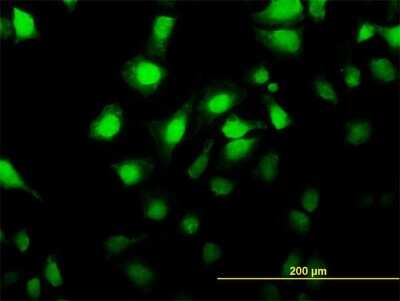 Immunocytochemistry/ Immunofluorescence: MNK2 Antibody (4F11) [H00002872-M04]