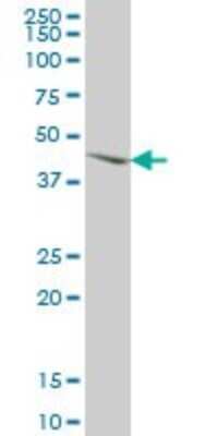 Western Blot: MNK2 Antibody (4F11) [H00002872-M04]