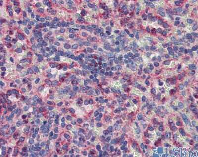 Immunohistochemistry: MNK2 Antibody [NBP1-58899]