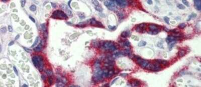 Immunohistochemistry-Paraffin: MNK2 Antibody [NBP1-58899]