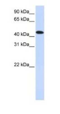 Western Blot: MNK2 Antibody [NBP1-58899]