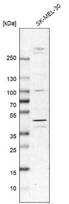 Western Blot: MNK2 Antibody [NBP1-92129]