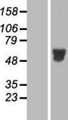 Western Blot: MNK2 Overexpression Lysate [NBL1-13124]