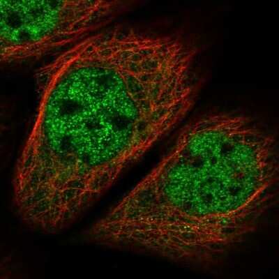 Immunocytochemistry/ Immunofluorescence: MNS1 Antibody [NBP1-83764]