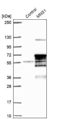 Western Blot: MNS1 Antibody [NBP1-83764]