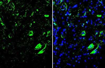 Immunohistochemistry-Frozen: MNX1/HLXB9 Antibody [NBP3-13412]