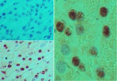 Immunohistochemistry-Paraffin: MNX1/HLXB9 Antibody [NBP2-24691]