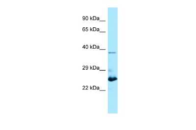 Western Blot: MOB4A Antibody [NBP2-86708]