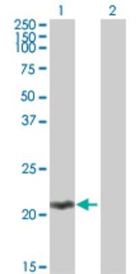 Western Blot: MOBKL2C Antibody [H00148932-B01P]