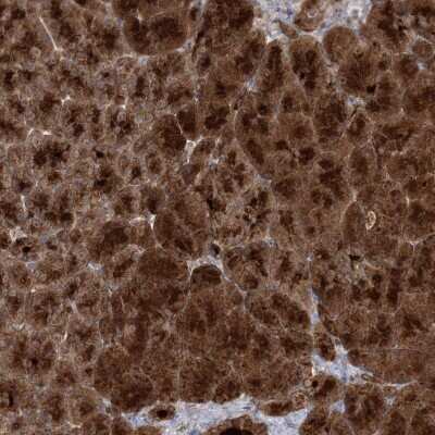 Immunohistochemistry: MOCS2 Antibody [NBP2-38359]