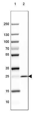 Western Blot: MOG Antibody (CL2852) [NBP2-46633]