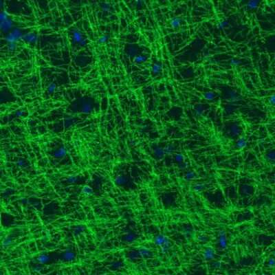 Immunohistochemistry: MOG Antibody (CL2858) [NBP2-46634]