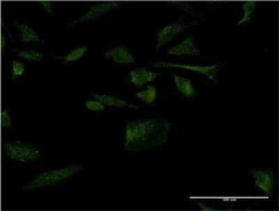 Immunocytochemistry/ Immunofluorescence: MOG1 Antibody (1H4) [H00029098-M02]