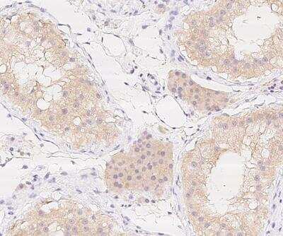 Immunohistochemistry-Paraffin: MOG1 Antibody [NBP3-12671]