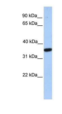 Western Blot: MOGAT1 Antibody [NBP1-59769]