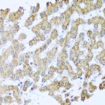 Immunohistochemistry-Paraffin: MOK Antibody - BSA Free [NBP2-94448]