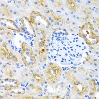 Immunohistochemistry-Paraffin: MOK Antibody - BSA Free [NBP2-94448]
