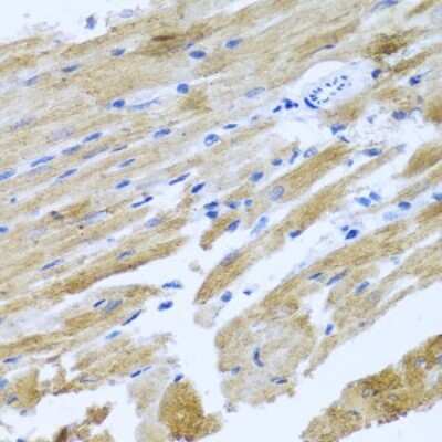 Immunohistochemistry-Paraffin: MOK Antibody - BSA Free [NBP2-94448]