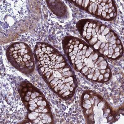 Immunohistochemistry-Paraffin: MON1B Antibody [NBP1-92131]