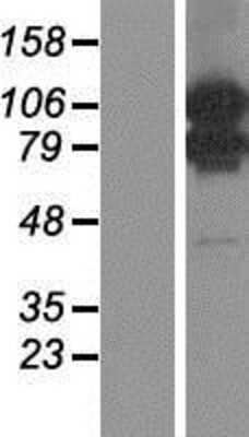 Western Blot: MORC1 Overexpression Lysate [NBP2-07337]