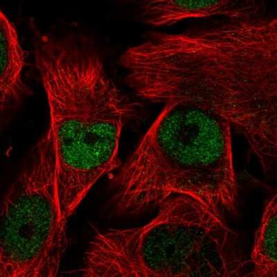 Immunocytochemistry/ Immunofluorescence: MORC2 Antibody [NBP1-89295]