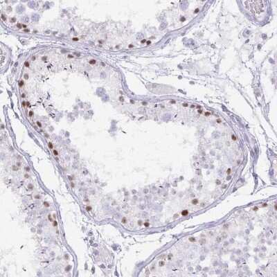 Immunohistochemistry-Paraffin: MORC4 Antibody [NBP2-33874]