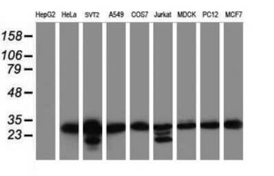 Western Blot: MORF4 Antibody (OTI5F2) [NBP2-45818]