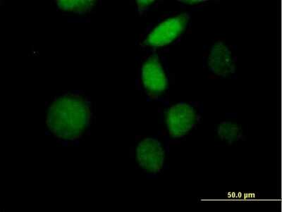 Immunocytochemistry/ Immunofluorescence: MORF4 Antibody [H00010934-B01P]