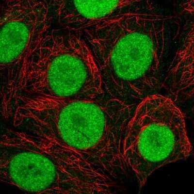 Immunocytochemistry/ Immunofluorescence: MORF4L2 Antibody [NBP2-58131]