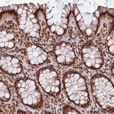 Immunohistochemistry-Paraffin: MORF4L2 Antibody [NBP2-47370]