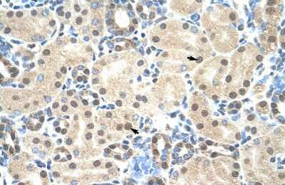 Immunohistochemistry: MORF4L2 Antibody [NBP2-87815]
