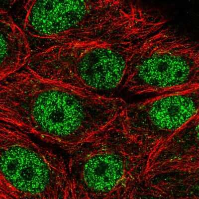 Immunocytochemistry/ Immunofluorescence: MORN2 Antibody [NBP2-34193]