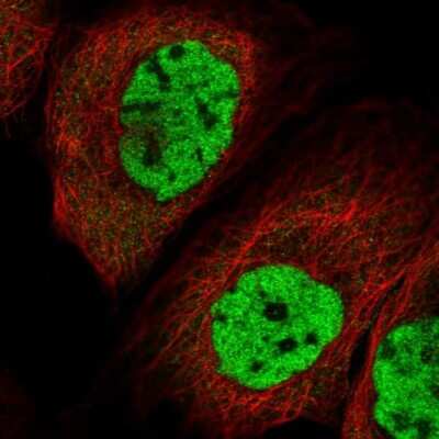 Immunocytochemistry/ Immunofluorescence: MORN3 Antibody [NBP2-31007]